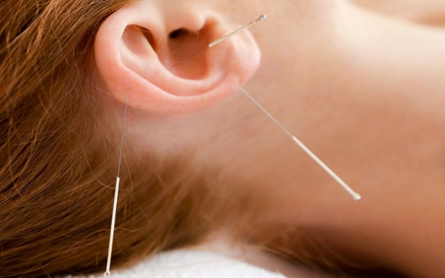 Ear_Acupuncture_640x400